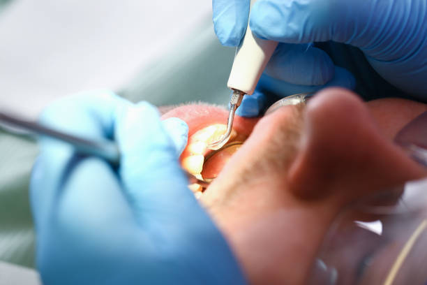 Best Emergency Tooth Extraction in Port Ewen, NY